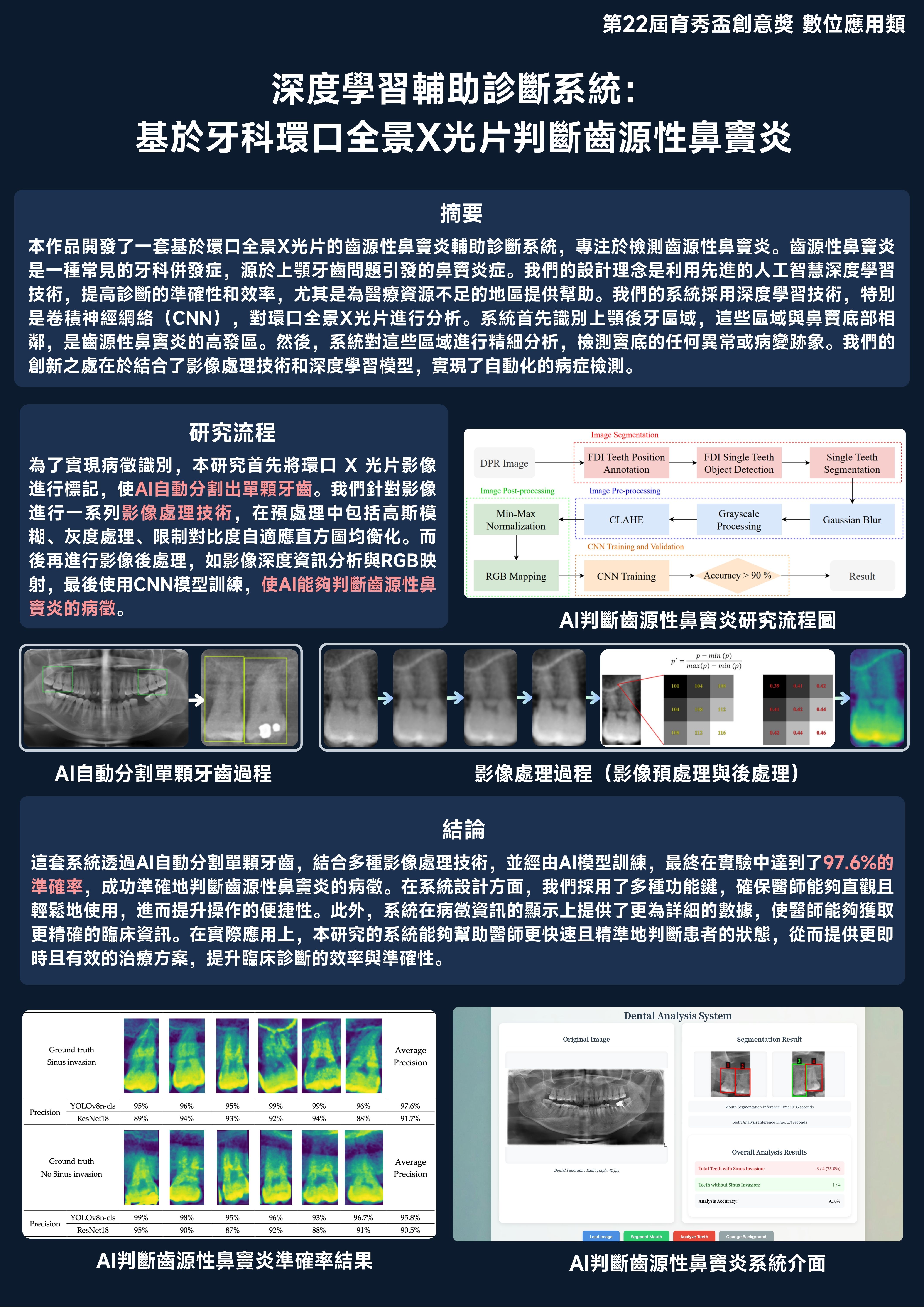 深度學習輔助診斷系統：基於牙科環口全景 X 光片判斷齒源性鼻竇炎