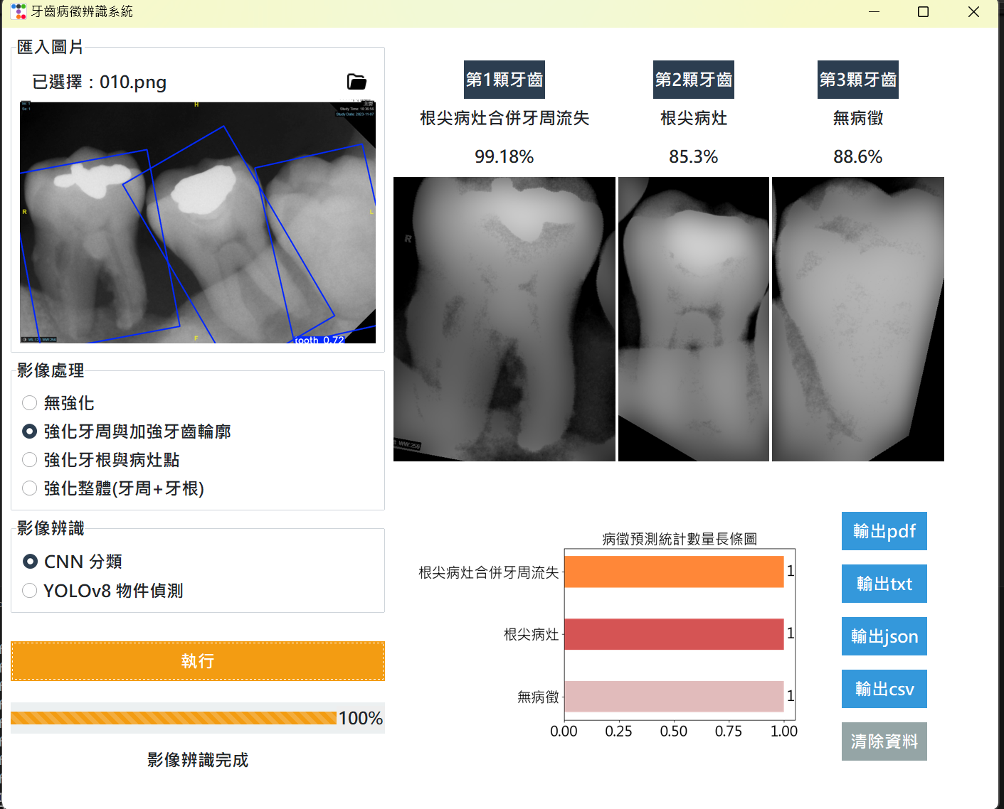 基於根尖片之影像分析與偵測系統