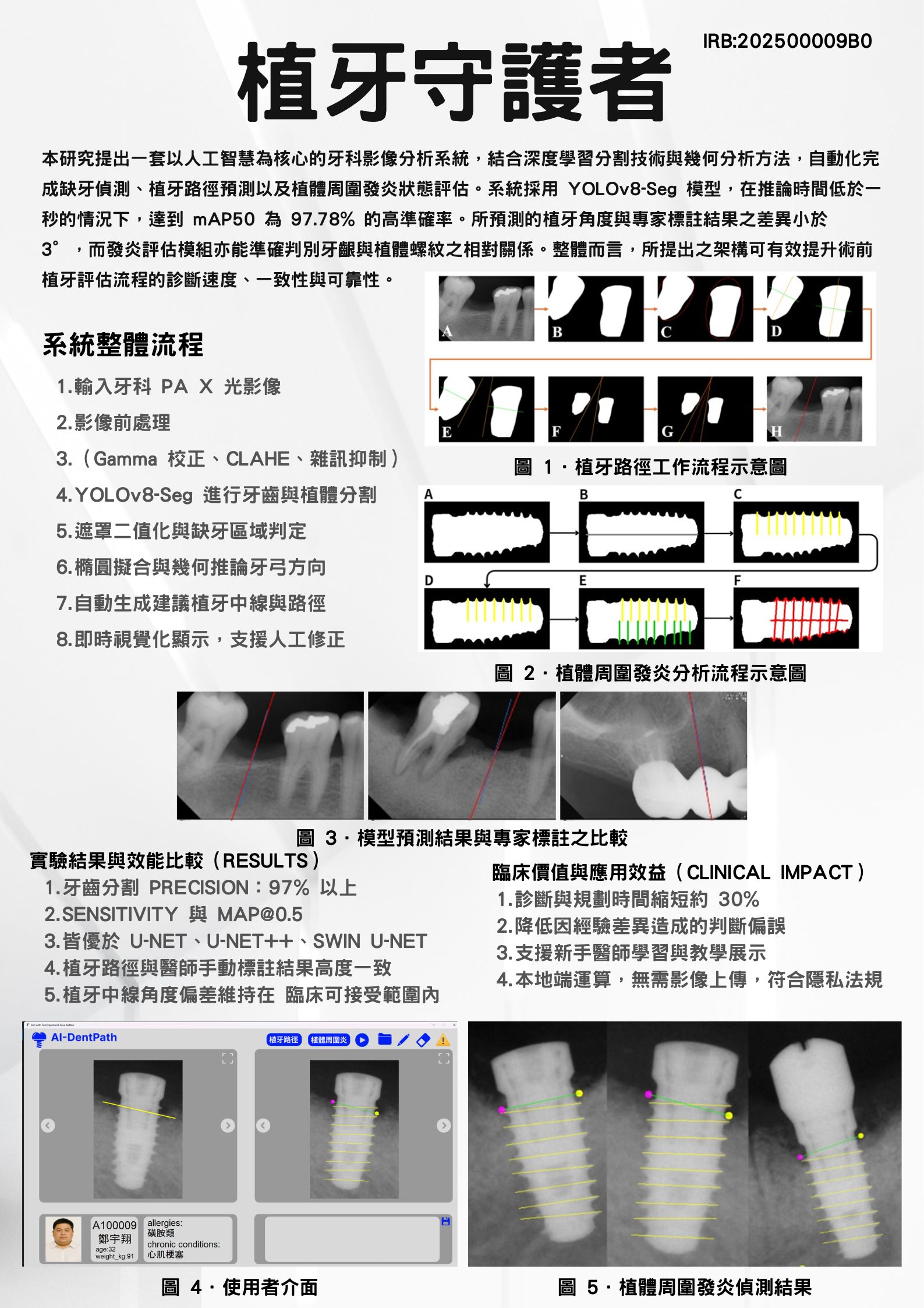 結合深度學習與幾何推論的智慧植牙輔助系統